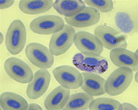  Leucocytozoon! Um Parasita Astuto Que Se Esconde nos Glóbulos Vermelhos dos Passarinhos