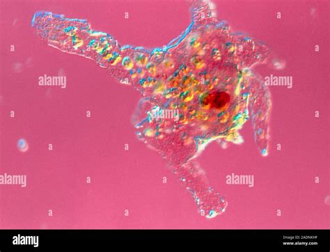  Proteus!  This Single-Celled Wonder Exemplifies Both Microscopic Simplicity and Remarkable Adaptation