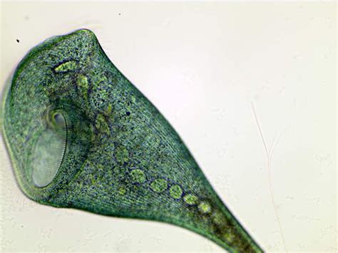  Xerodiscus: Descubra Este Ciliophora Delicadamente Atraente Que Adora Dançar com as Ondas!